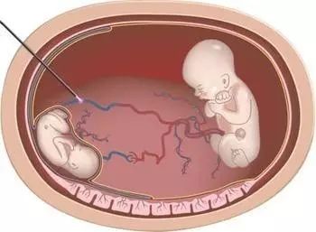 再起风云 视频缩略图