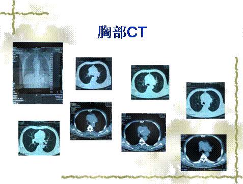 例外 视频缩略图